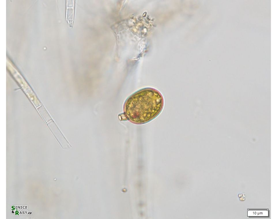 Trachelomonas similis