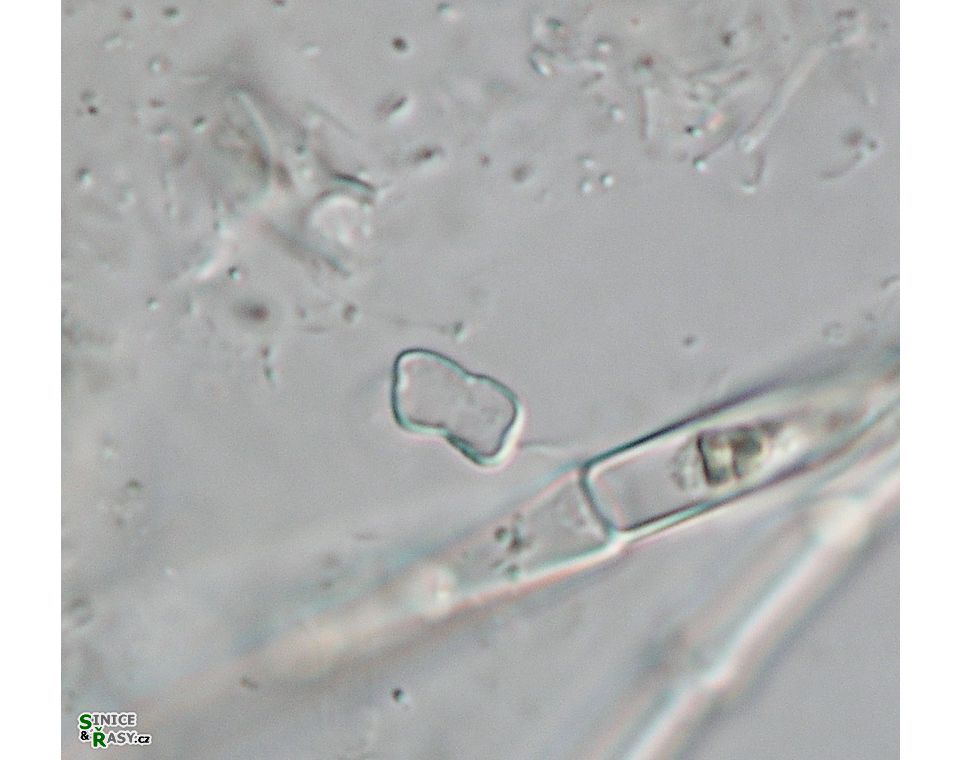 Actinotaenium geniculatum