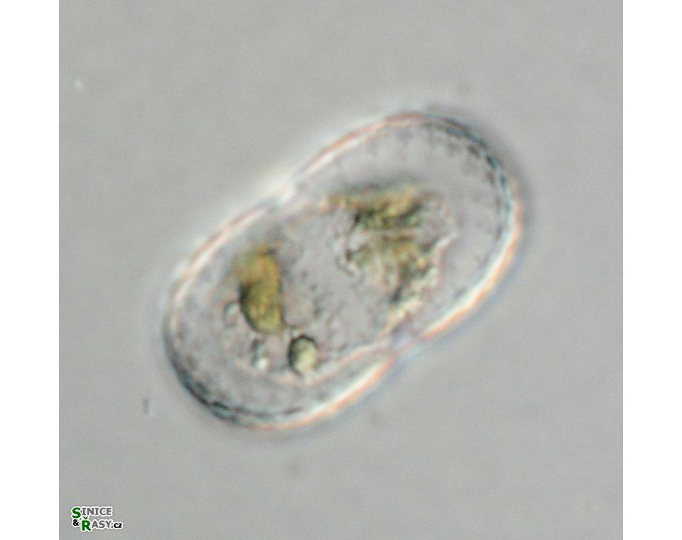 Actinotaenium trachypolum