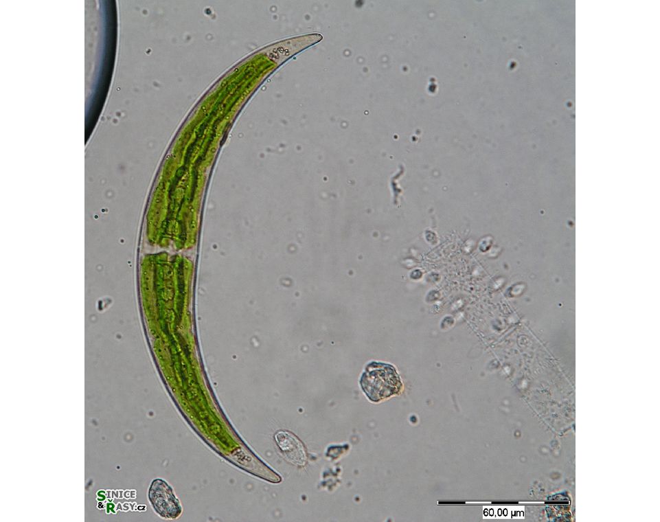 Closterium dianae