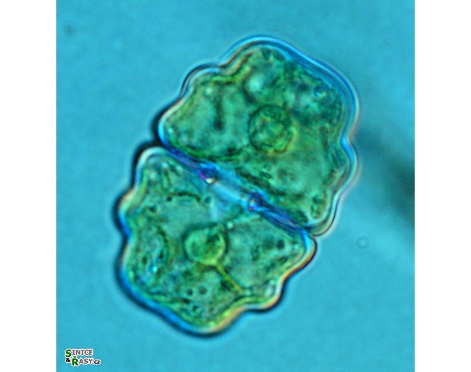 Cosmarium venustum