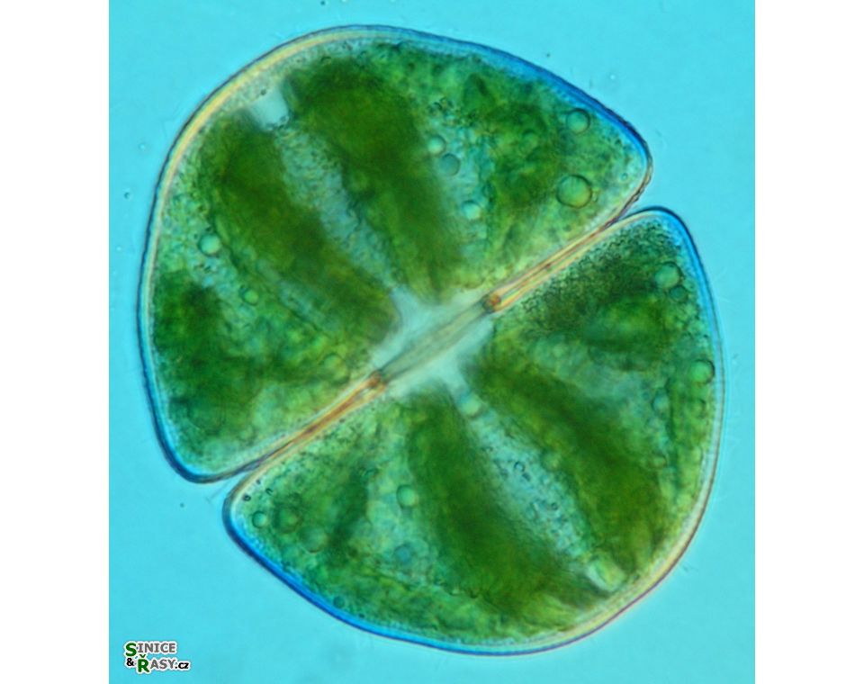 Micrasterias ralfsii
