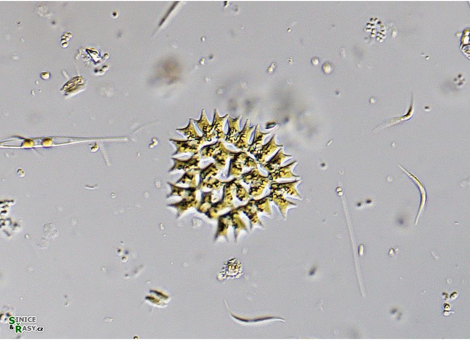 Parapediastrum biradiatum