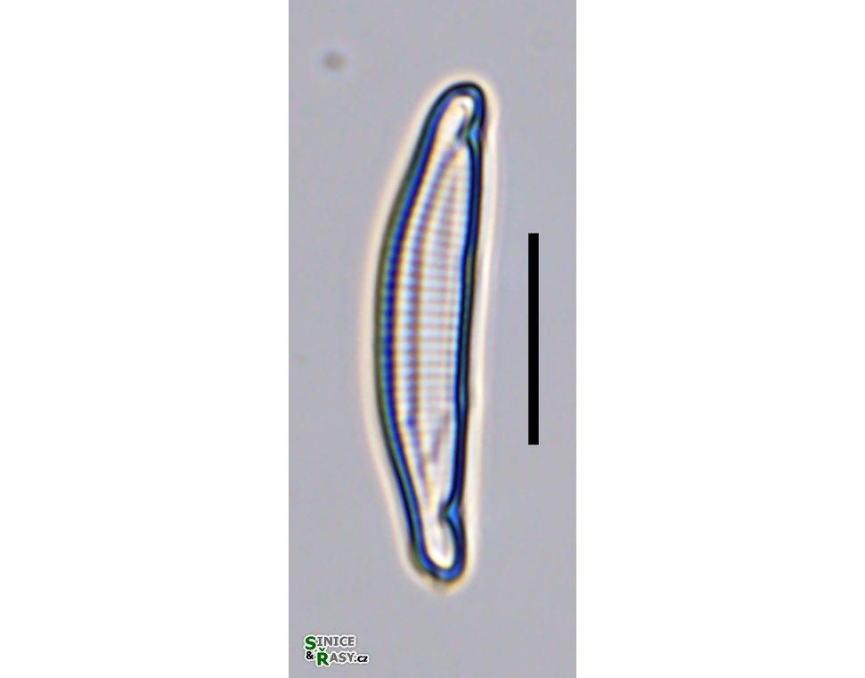 Eunotia incisa