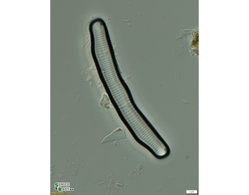 Eunotia pectinalis