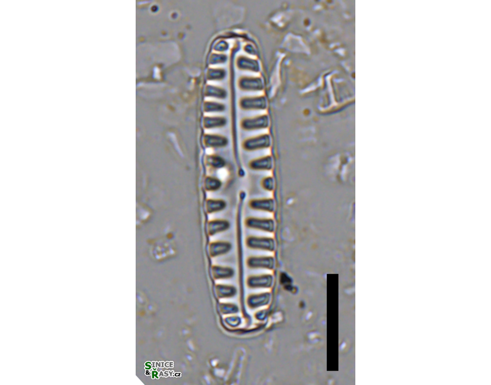 Pinnularia borealis