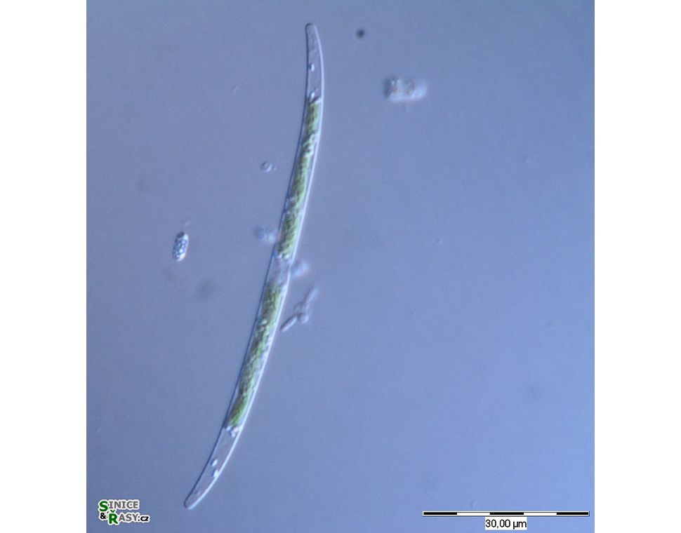 Closterium gracile