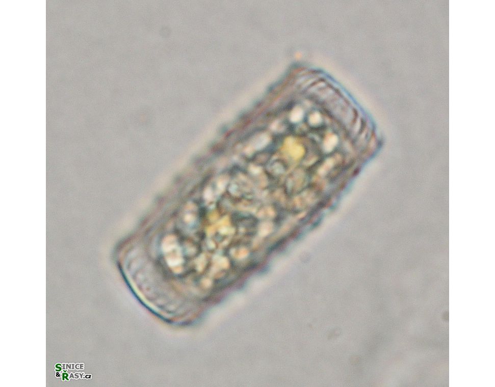 Cosmarium annulatum