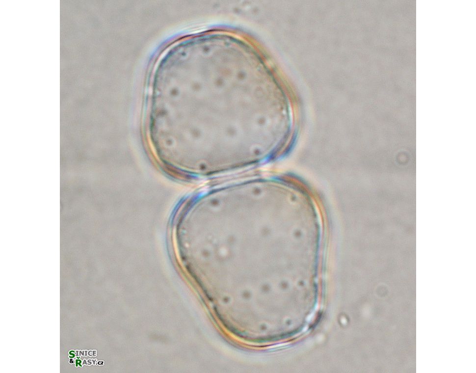 Cosmarium zonatum