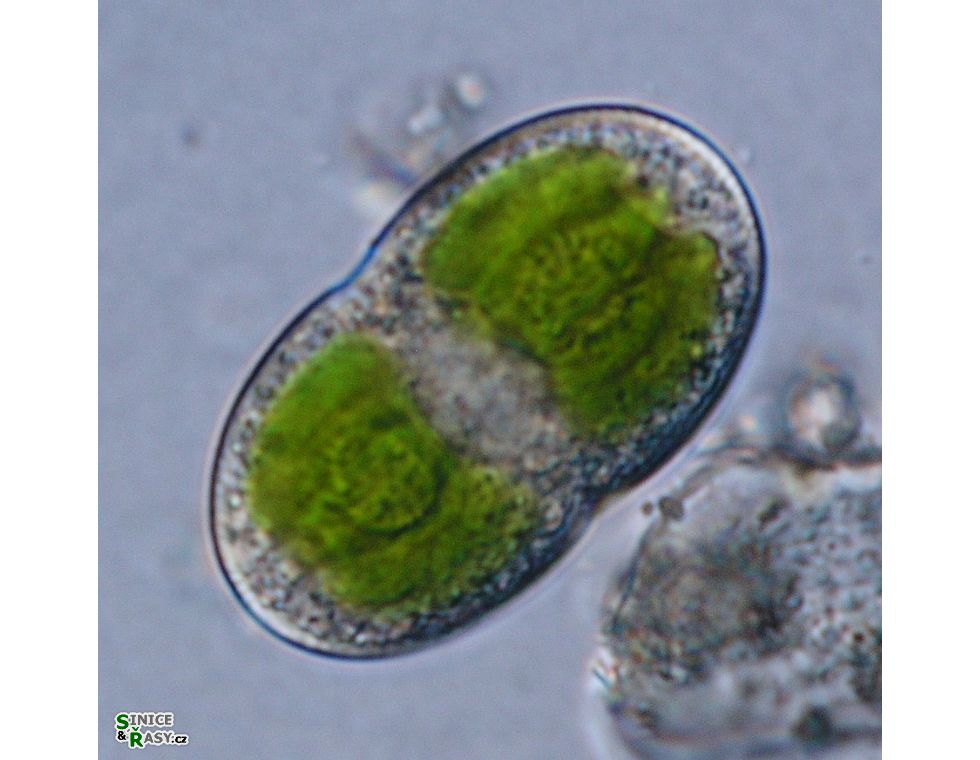 Actinotaenium