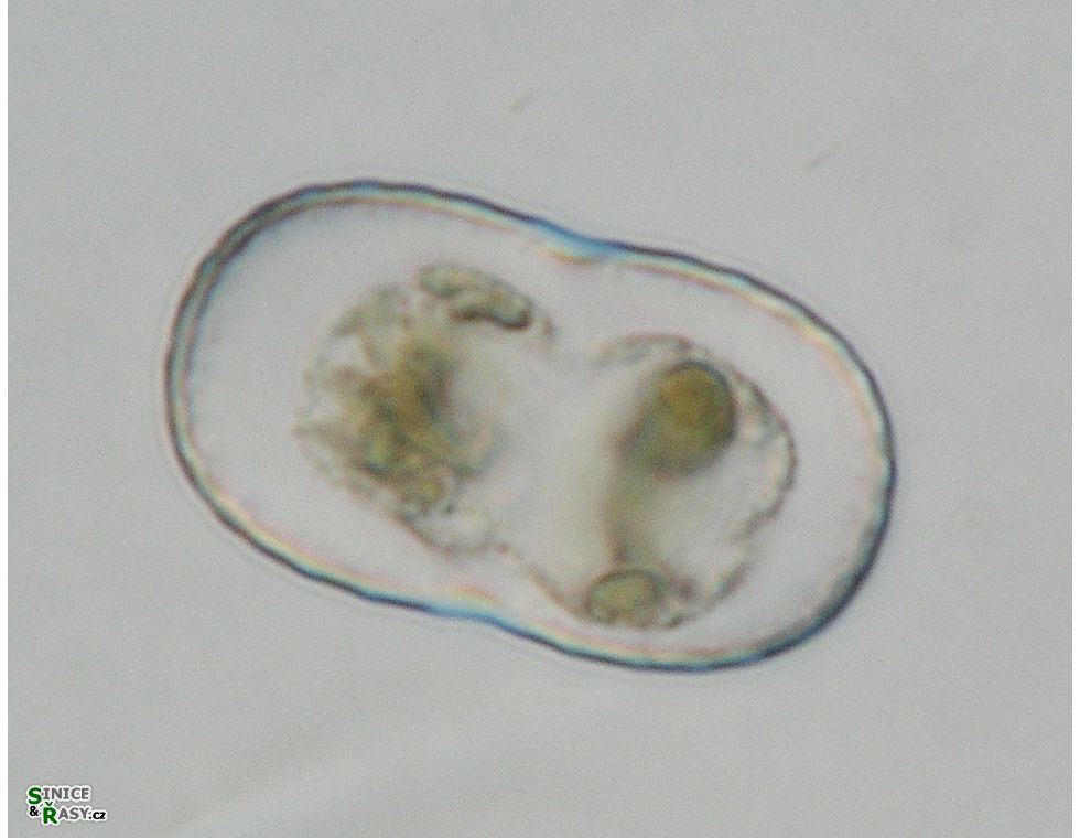 Actinotaenium trachypolum