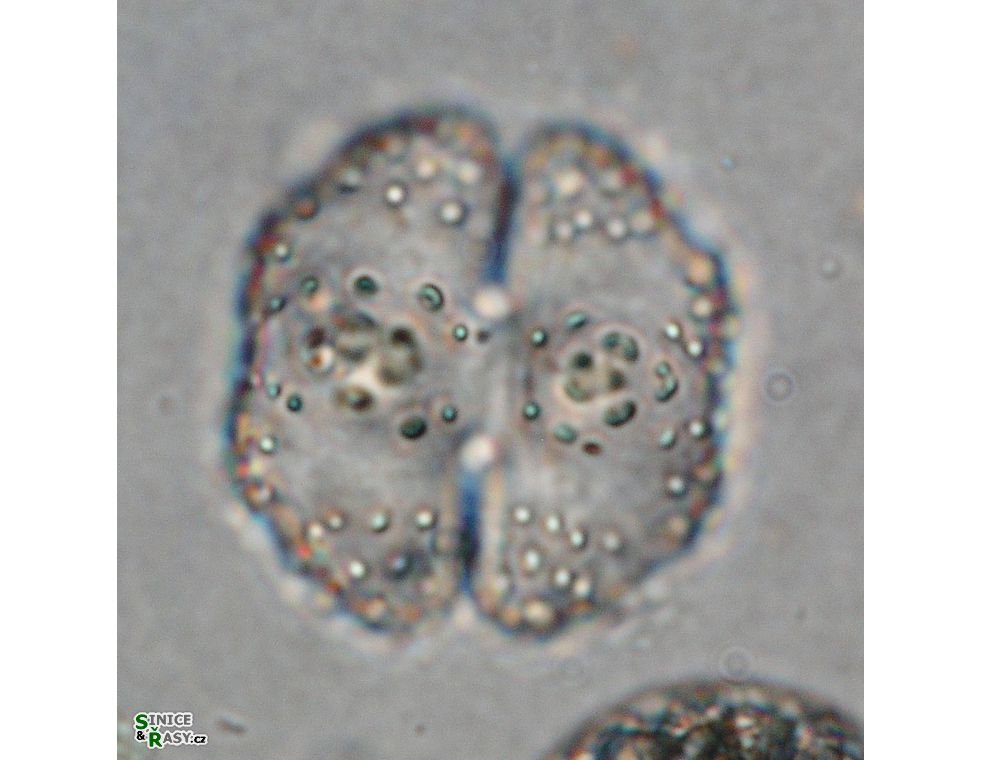 Cosmarium corbula