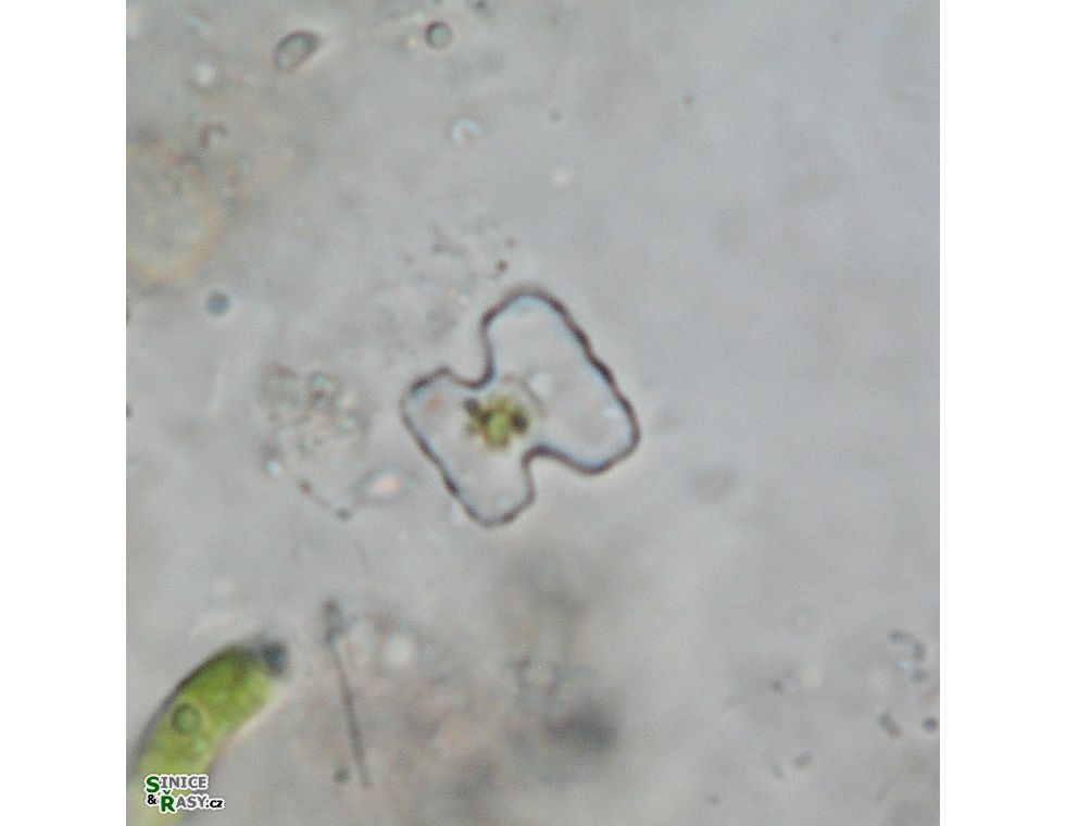 Cosmarium cymatonotophorum