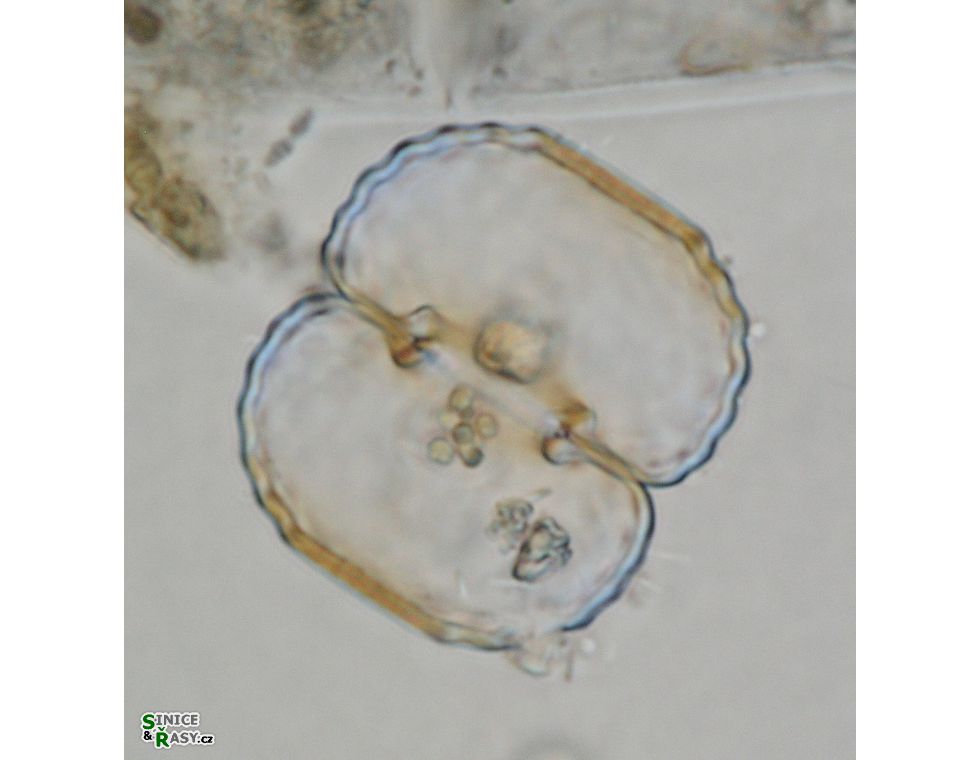 Cosmarium fastidiosum