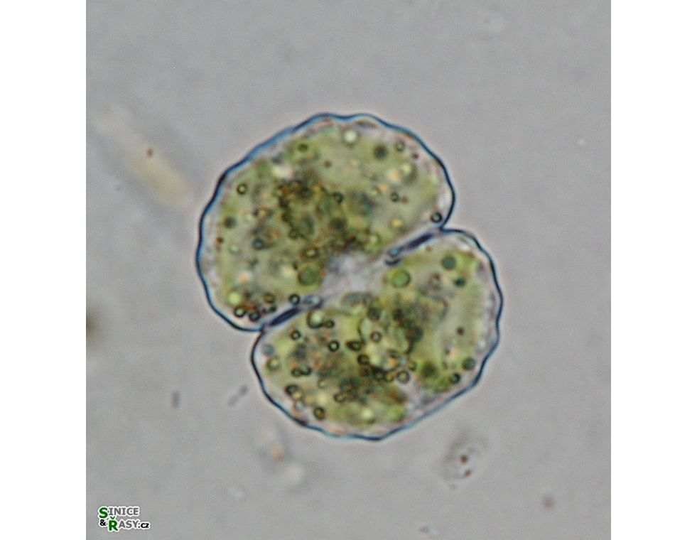 Cosmarium gibberulum