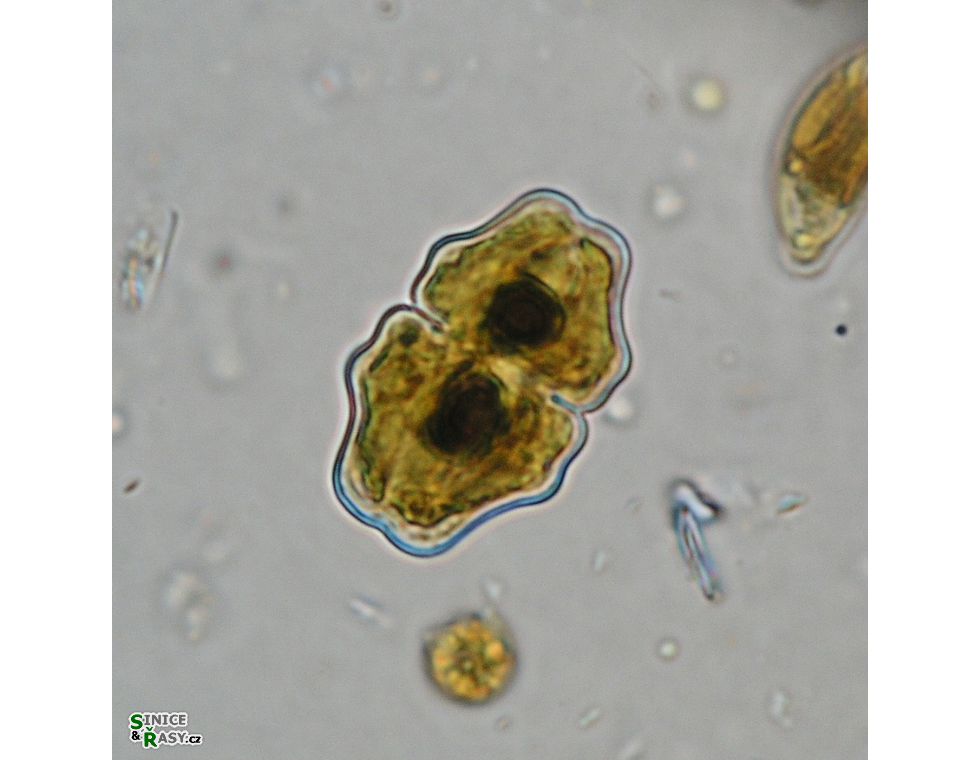 Cosmarium pokornyanum