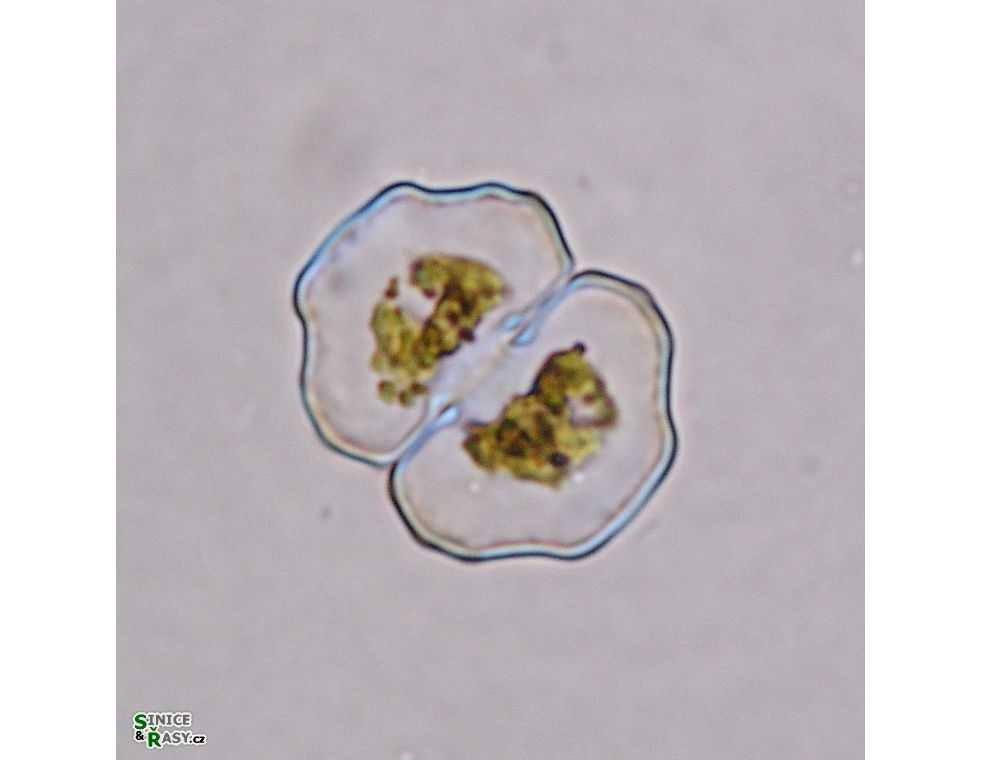 Cosmarium pseudoretusum