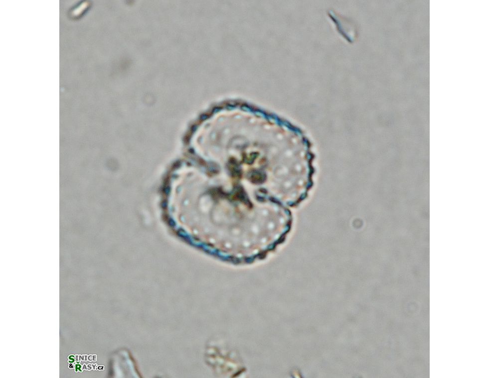 Cosmarium vogesiacum