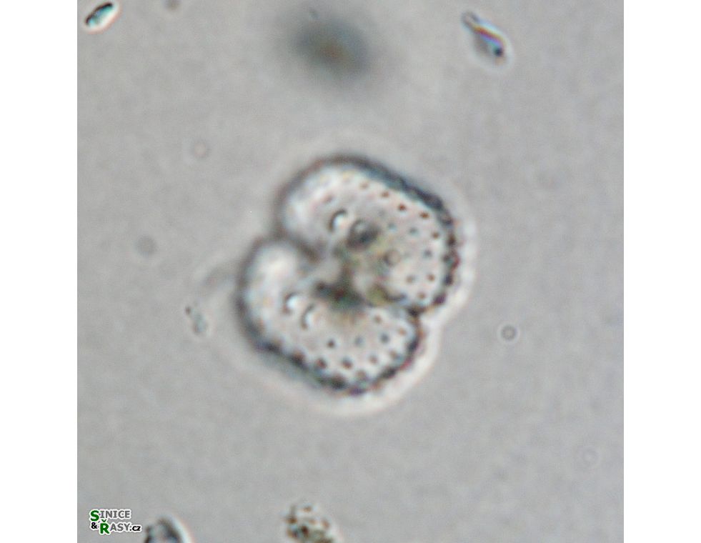 Cosmarium vogesiacum