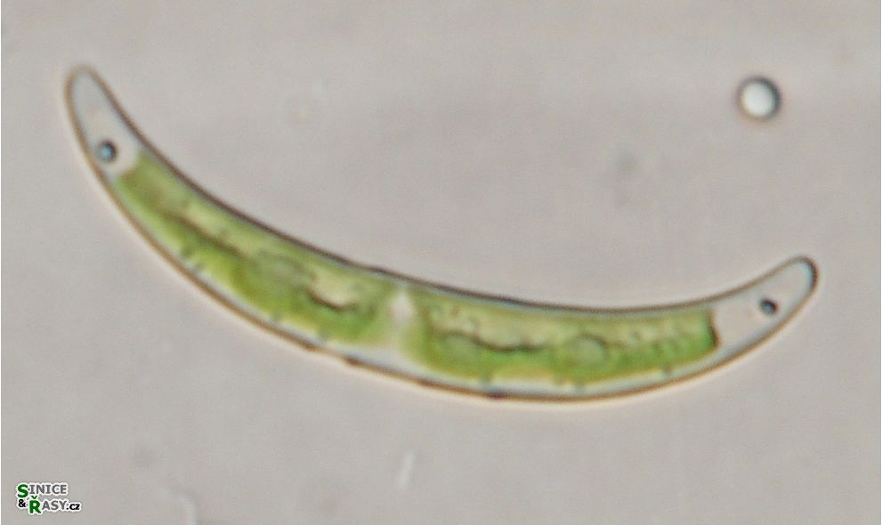 Closterium pseudopygmaeum