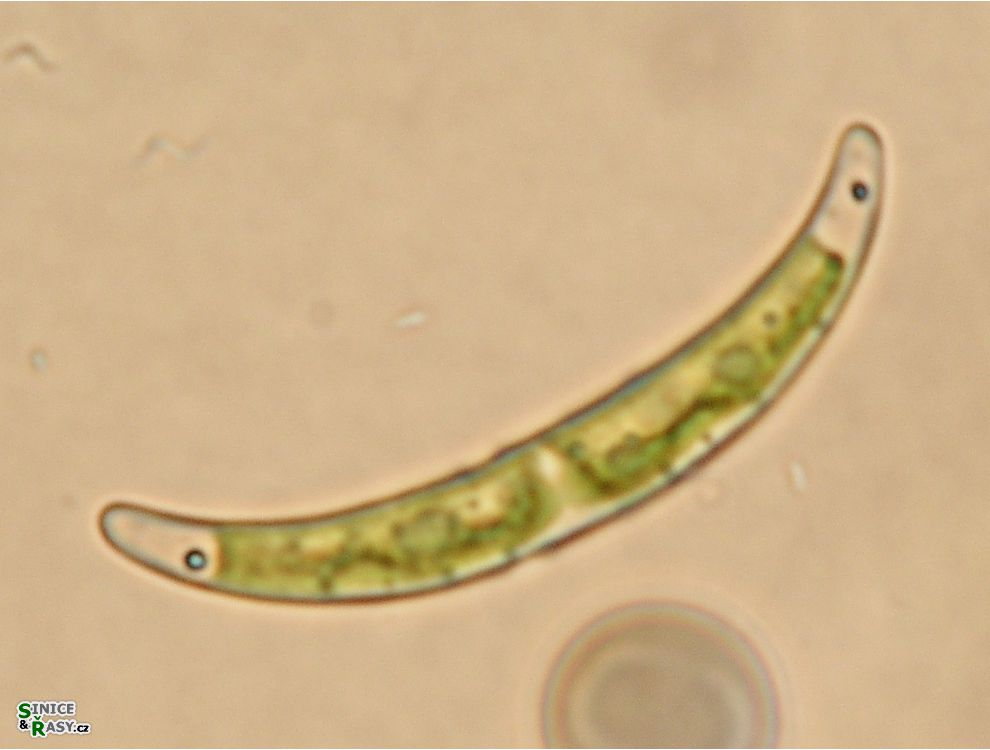 Closterium pseudopygmaeum