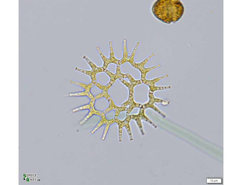 Lacunastrum gracillimum