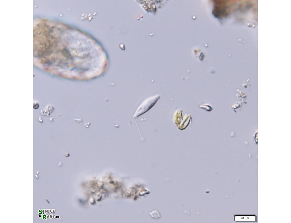 Sphenomonas teres