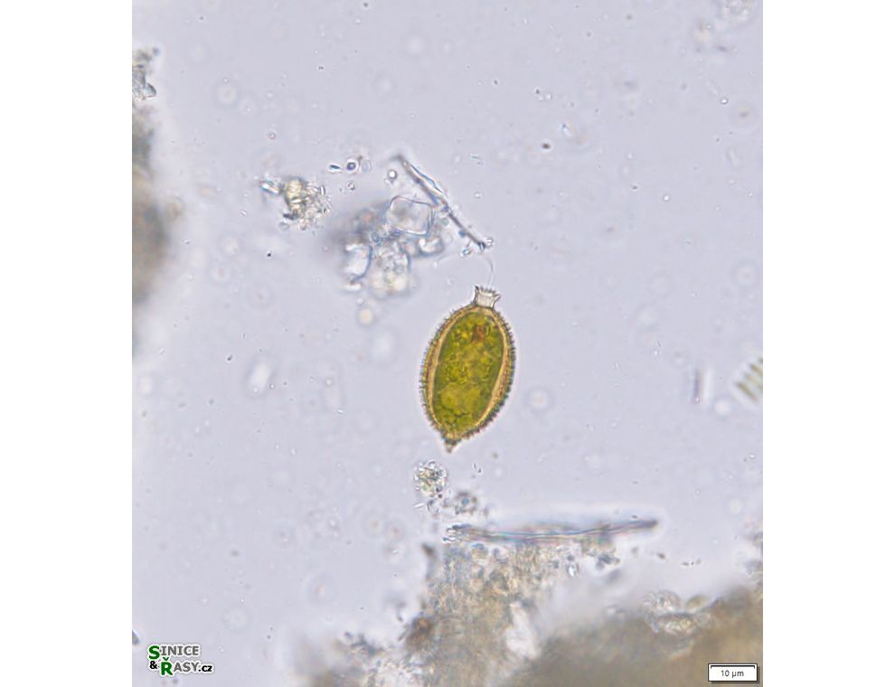 Trachelomonas caudata