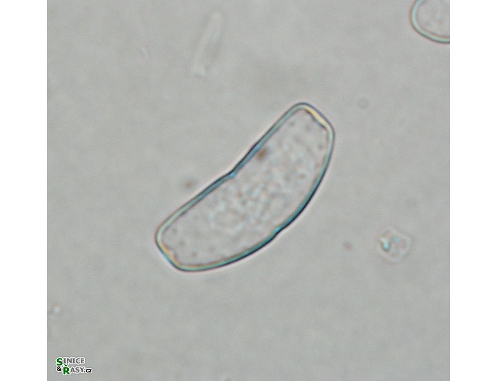 Actinotaenium infractum