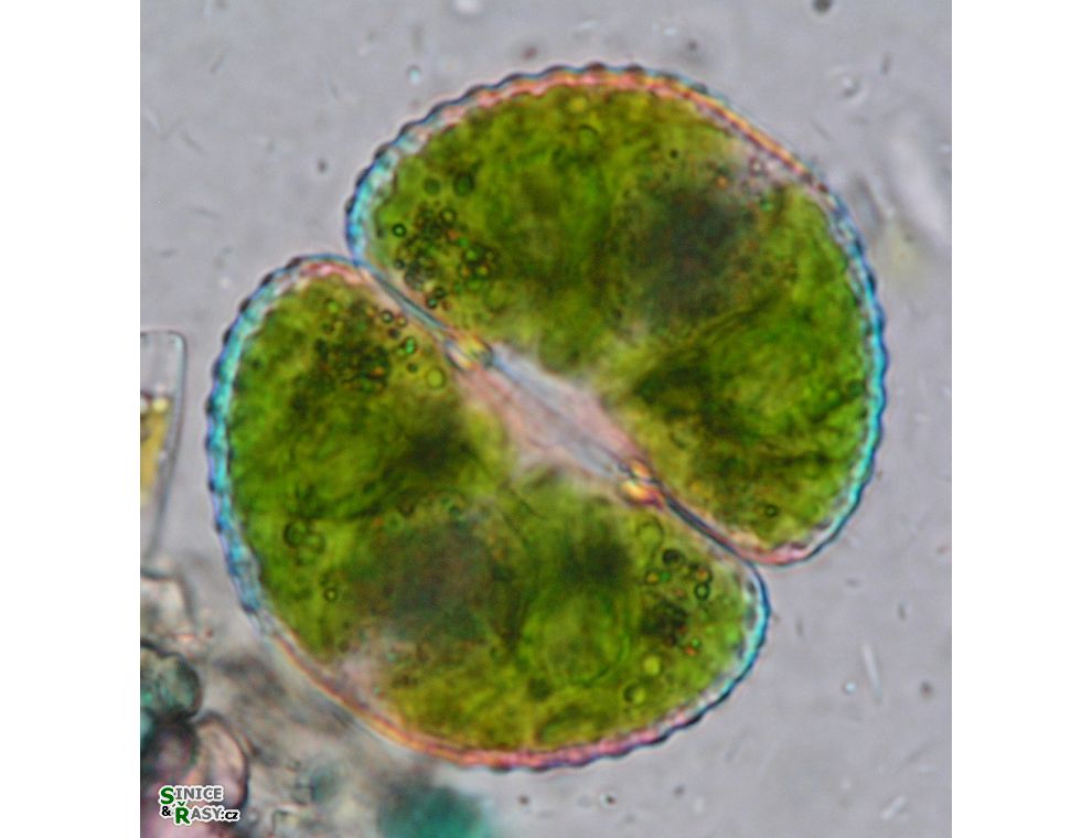 Cosmarium botrytis