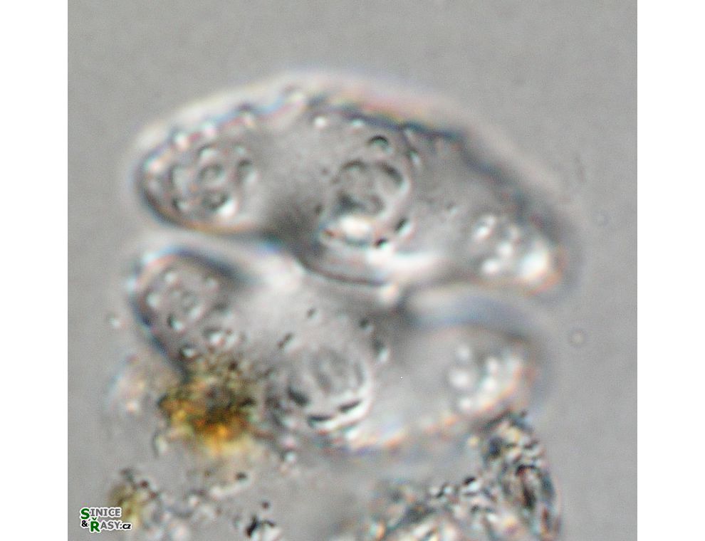 Cosmarium commissurale