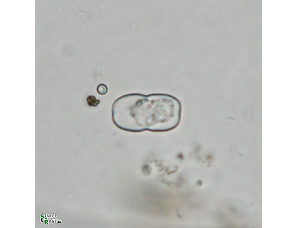 Cosmarium gonoides