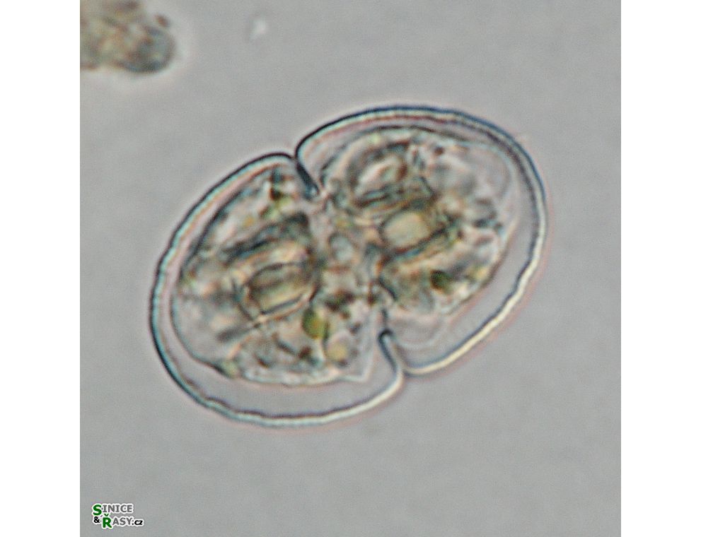 Cosmarium microsphinctum