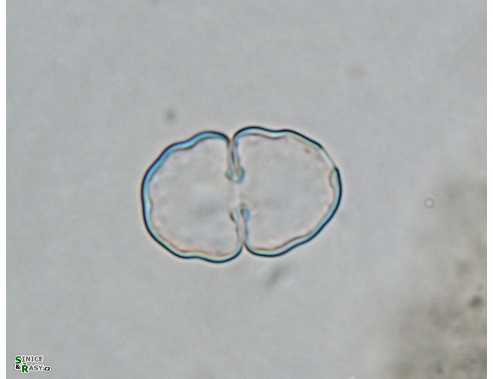 Cosmarium paragranatoides