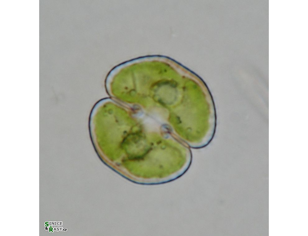 Cosmarium phaseolus