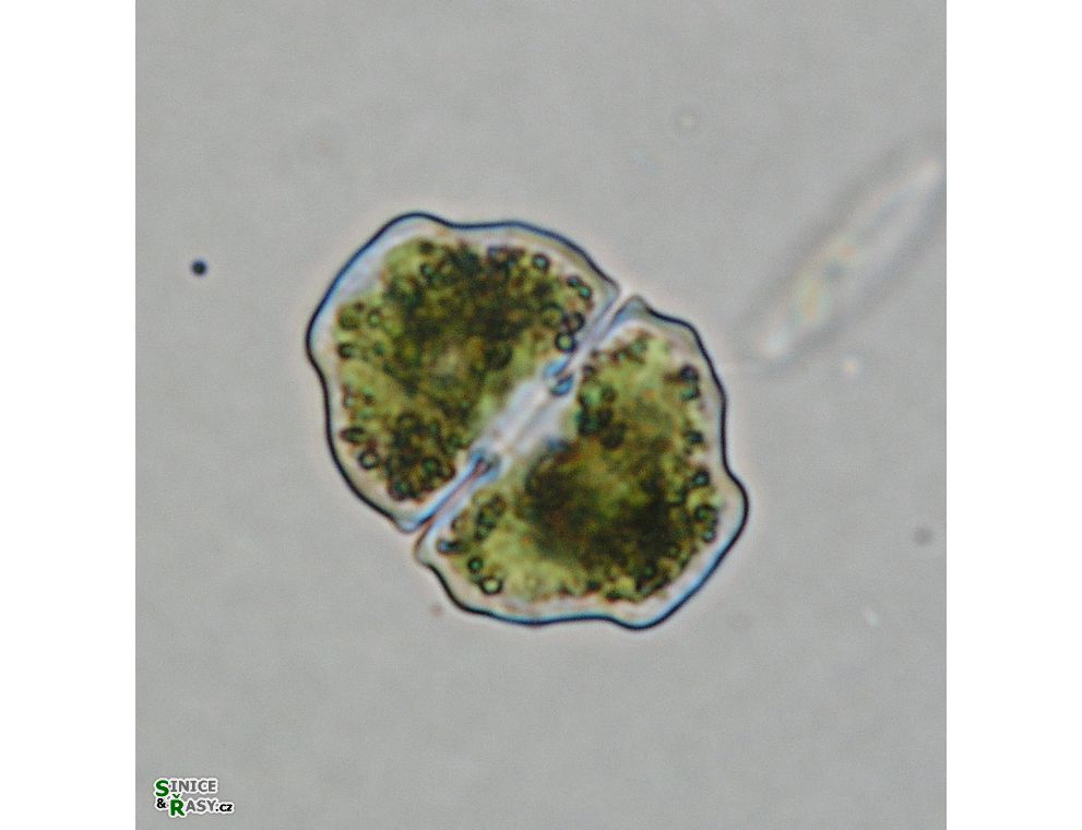 Cosmarium pseudoretusum