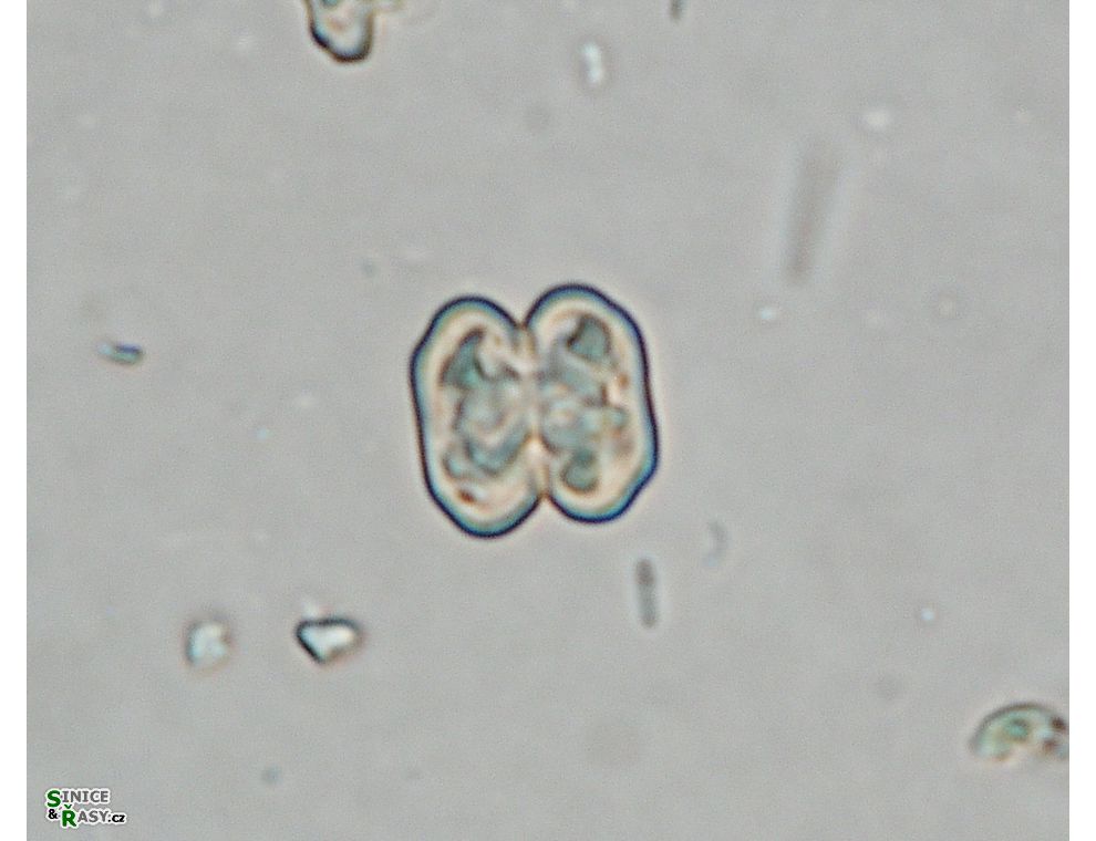 Cosmarium tinctum