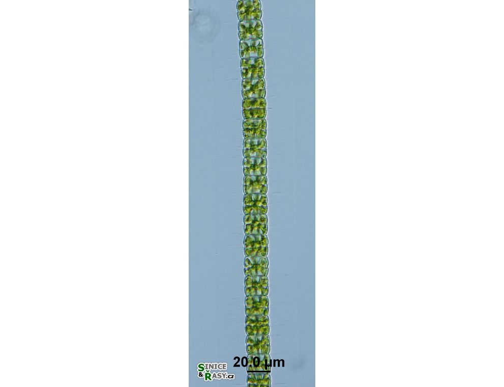 Hyalotheca dissiliens